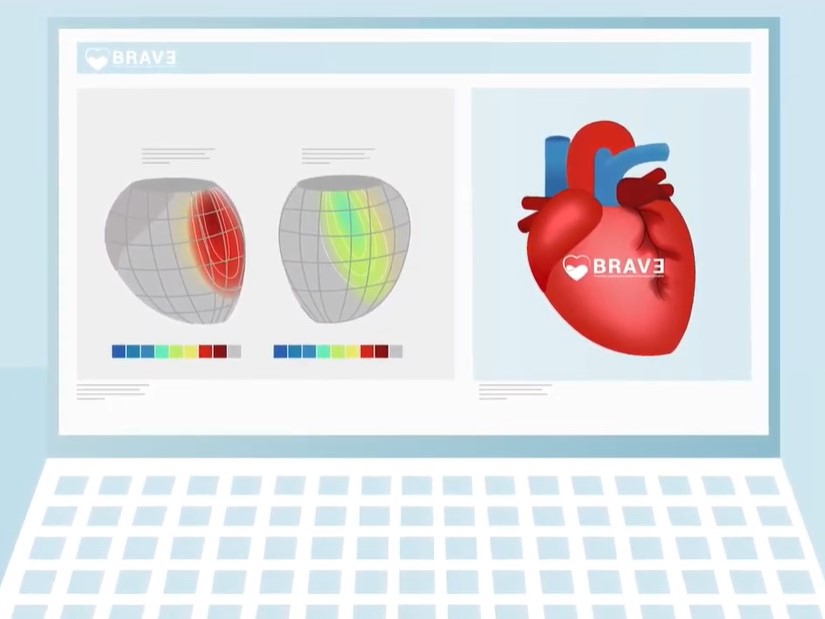 Simulation BRAV3